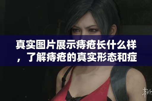 真实图片展示痔疮长什么样，了解痔疮的真实形态和症状
